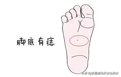 脚底长痣代表什么（老人言脚底有痣难富贵是真的嘛）